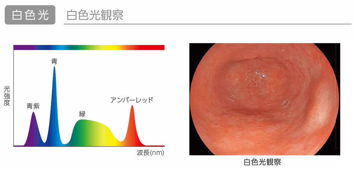 ELUXEO 8000の特徴