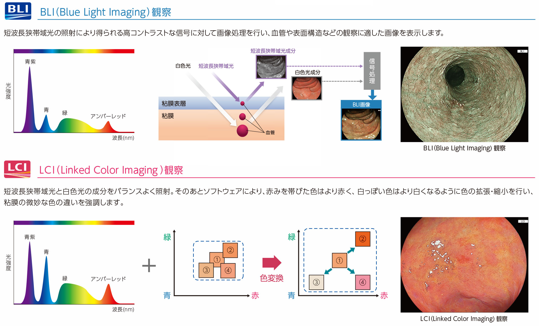 ELUXEO 8000の特徴