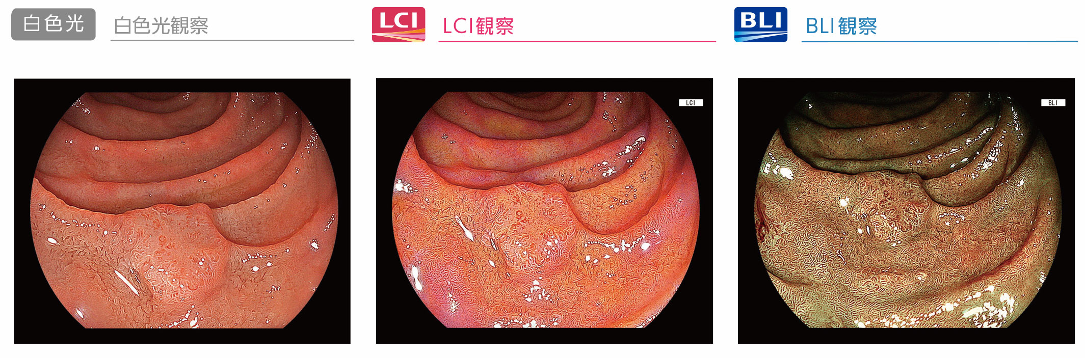 BLI/LCI観察イメージ