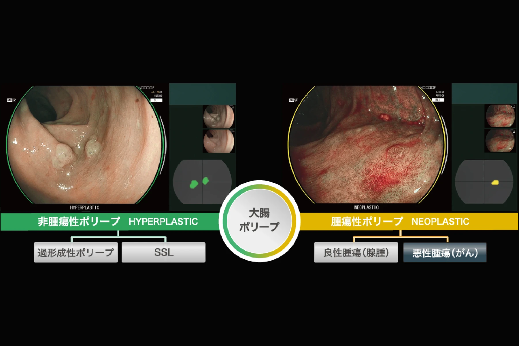 AI診断の画像